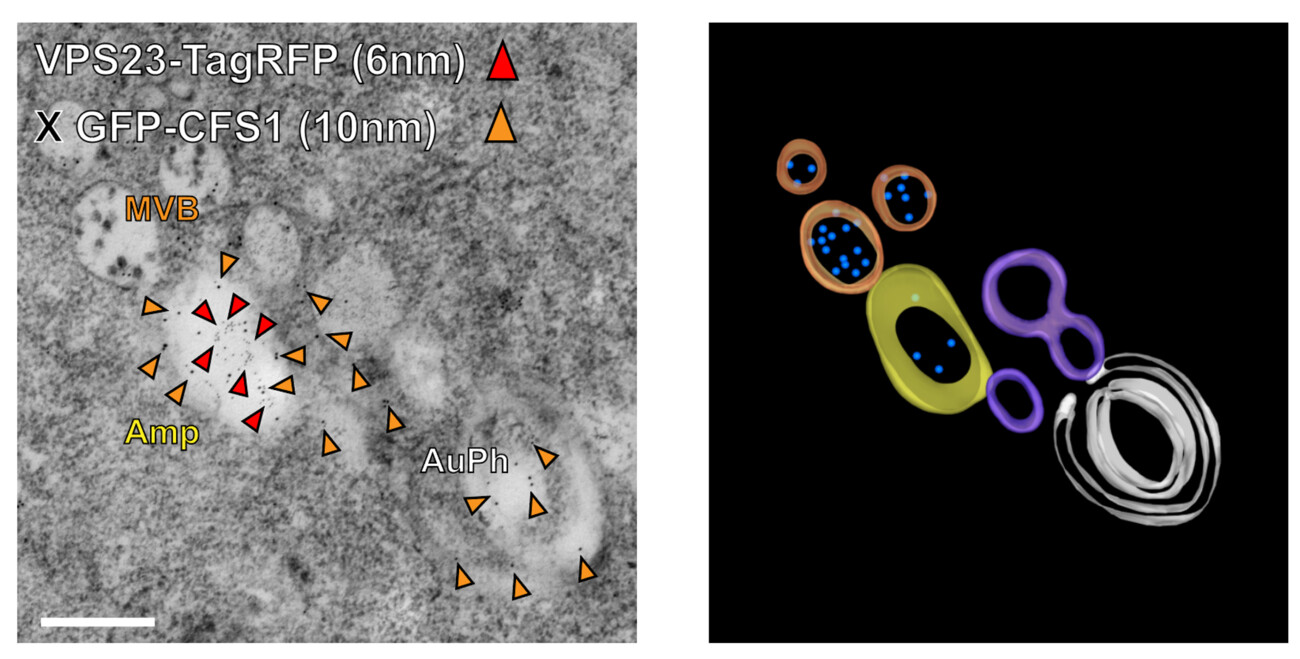 Microscopy of autophagosomes maturing into amphisomes